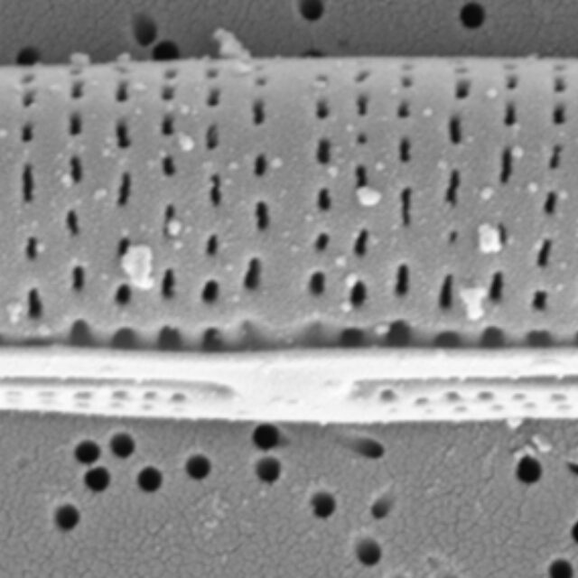 Tursiocola cymbelloides SEM1