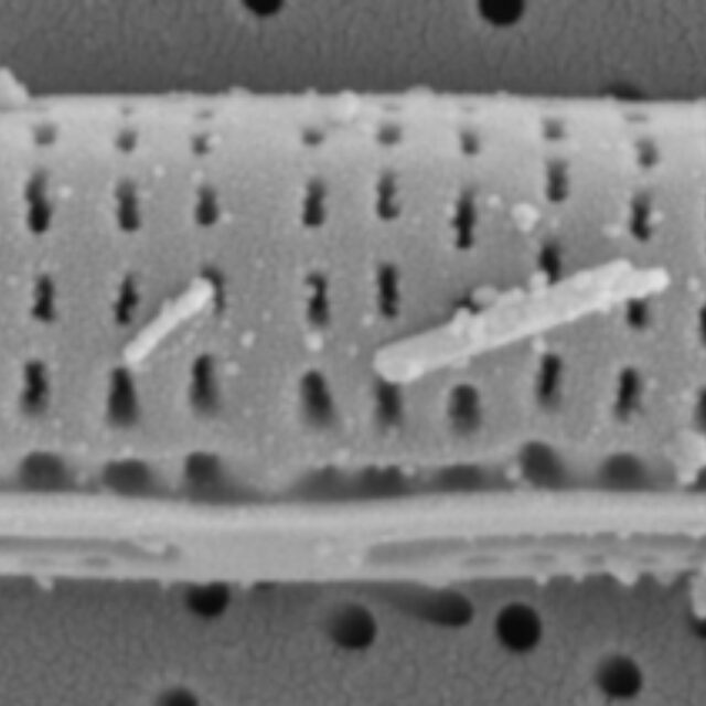 Tursiocola cymbelloides SEM2