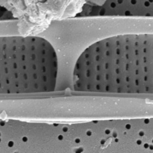 Tursiocola cymbelloides SEM3