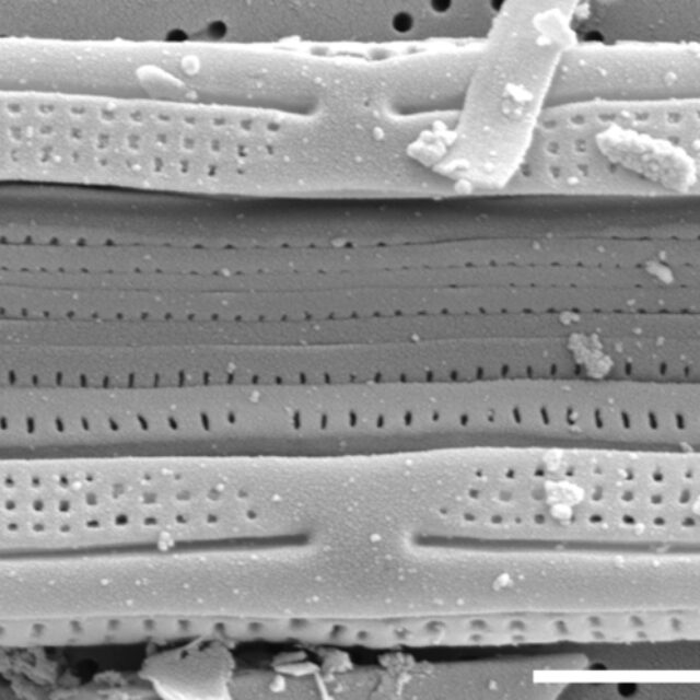 Tursiocola cymbelloides SEM4