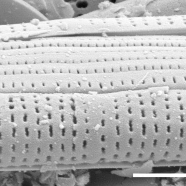 Tursiocola cymbelloides SEM5