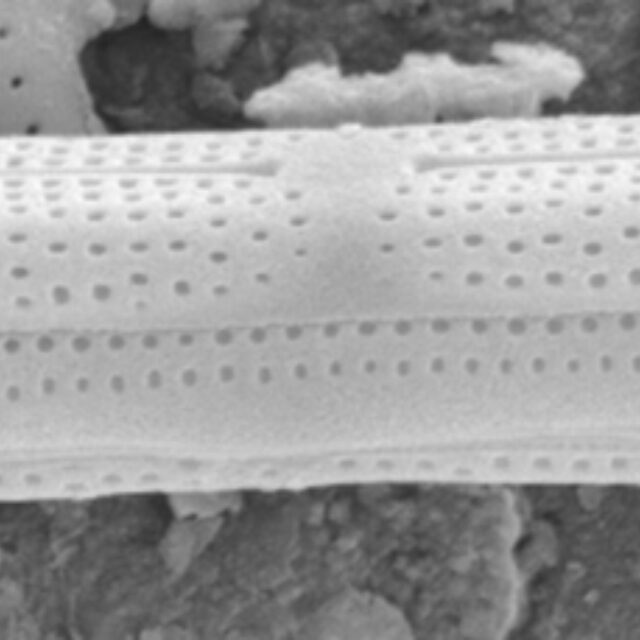 Tursiocola gracilis SEM1