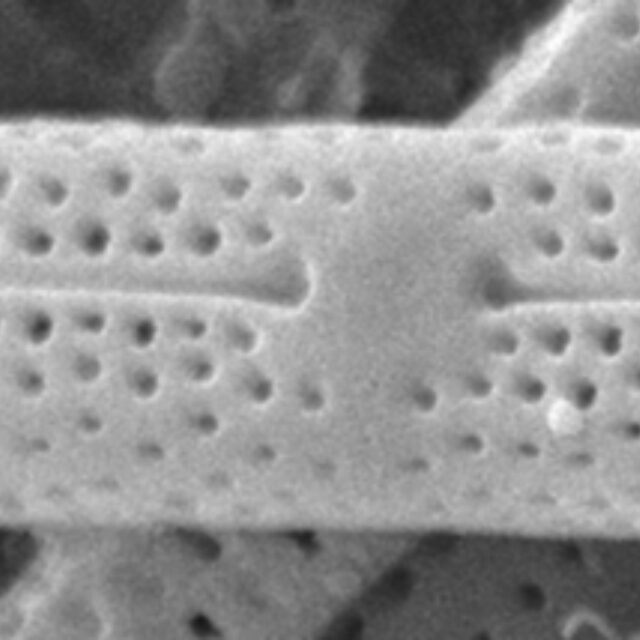 Tursiocola gracilis SEM2