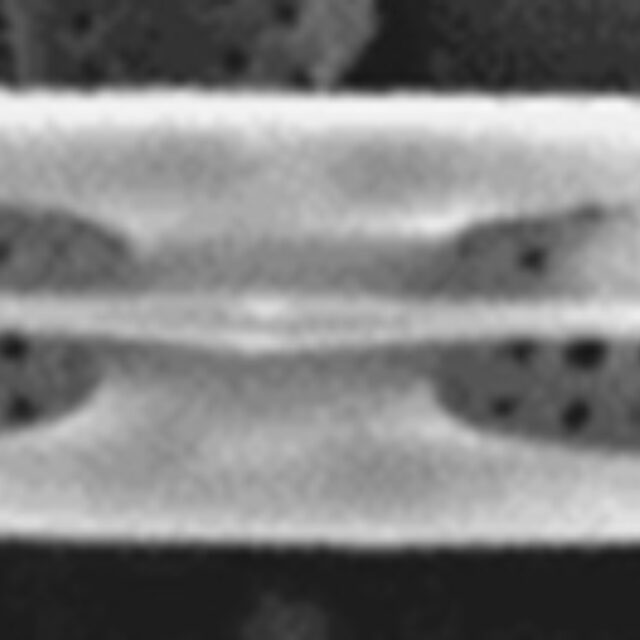 Tursiocola gracilis SEM3