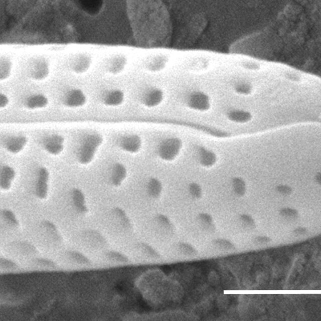 Tursiocola gracilis SEM4