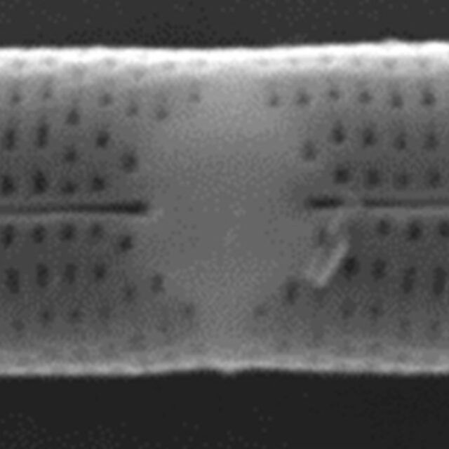 Tursiocola varicopulifera SEM1