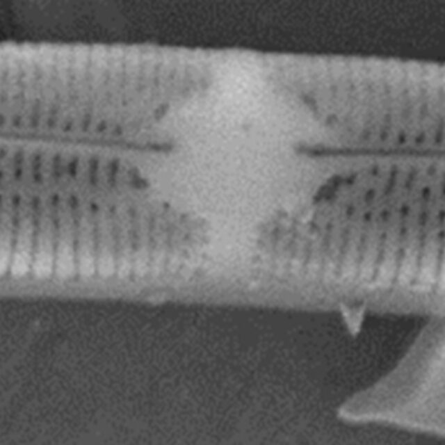 Tursiocola varicopulifera SEM2