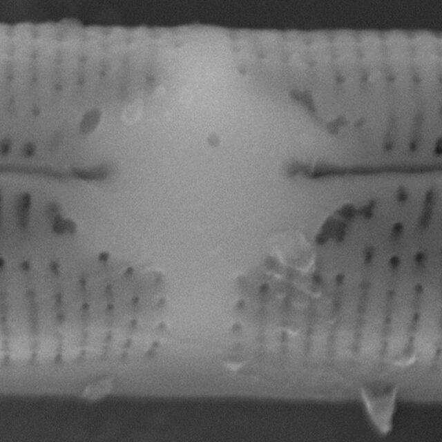 Tursiocola varicopulifera SEM3