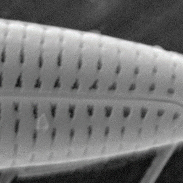 Tursiocola varicopulifera SEM4