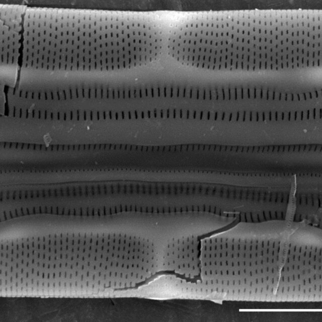 Tursiocola varicopulifera SEM5