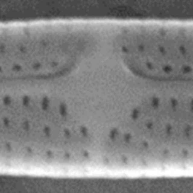 Tursiocola ziemanii SEM1