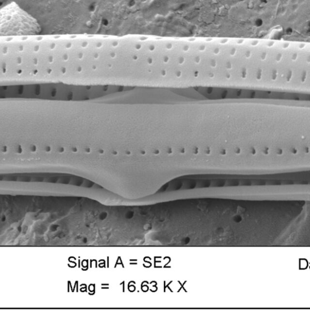 Tursiocola ziemanii SEM2