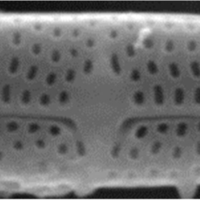 Tursiocola ziemanii SEM2