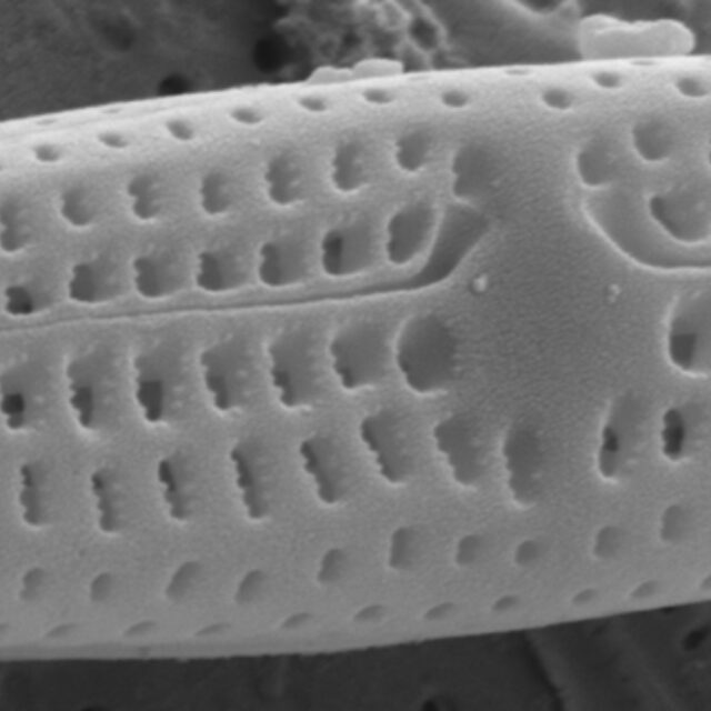 Tursiocola ziemanii SEM3