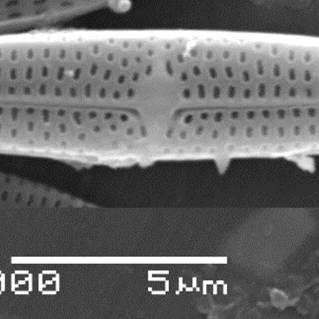 Tursiocola ziemanii SEM4