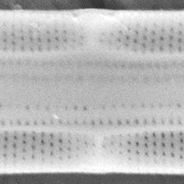 Tursiocola ziemanii SEM4