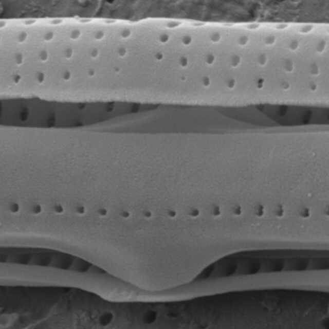 Tursiocola ziemanii SEM5