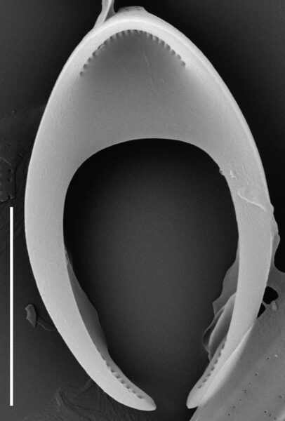 Tetracyclus hinziae SEM1