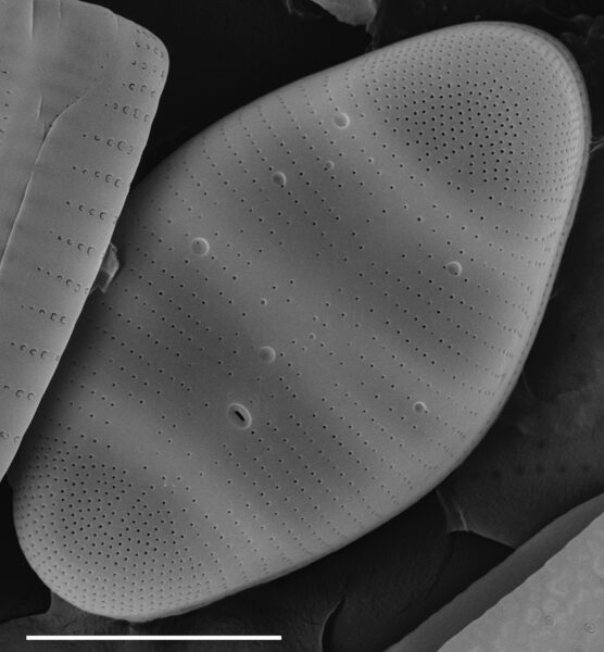 Tetracyclus hinziae SEM2