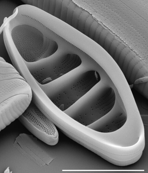 Tetracyclus hinziae SEM3